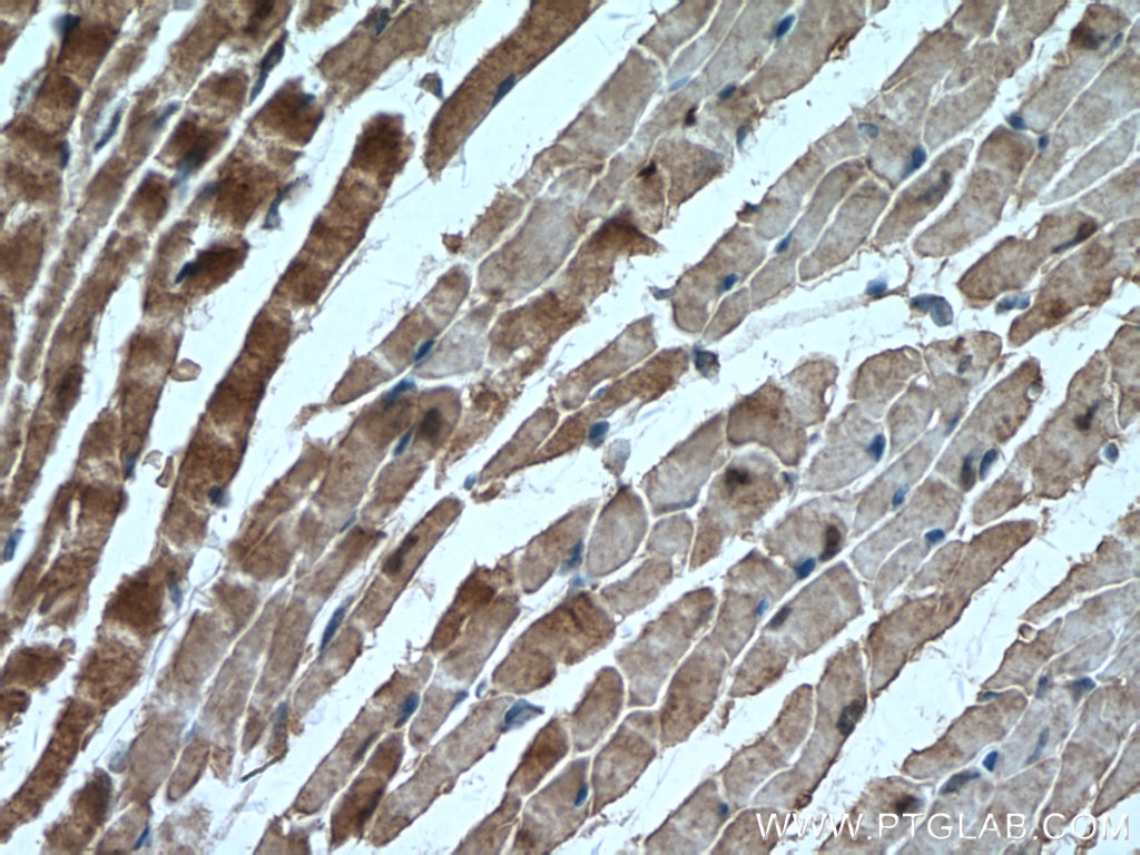 Immunohistochemistry (IHC) staining of mouse heart tissue using AK1 Polyclonal antibody (14978-1-AP)