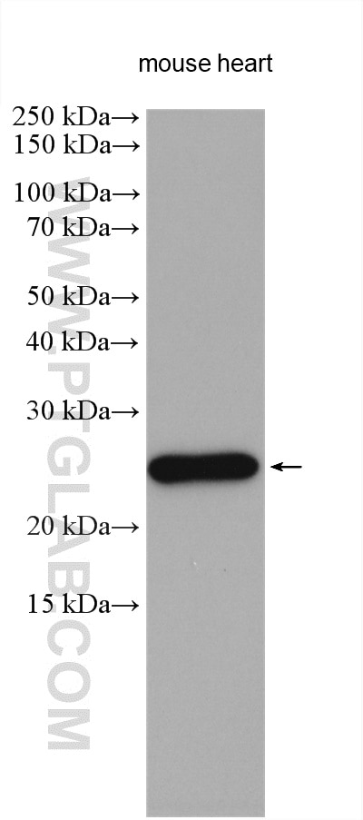 Western Blot (WB) analysis of various lysates using AK1 Polyclonal antibody (14978-1-AP)