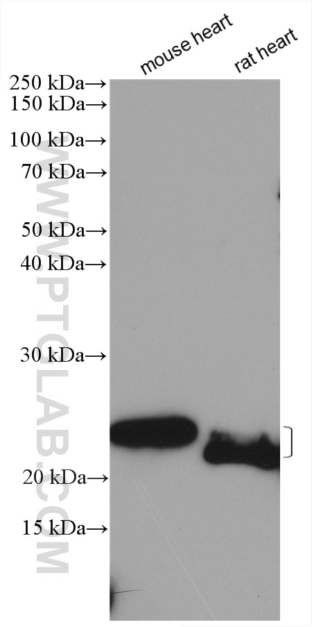 Western Blot (WB) analysis of various lysates using AK1 Polyclonal antibody (14978-1-AP)