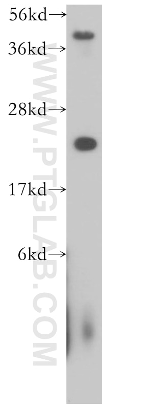 Western Blot (WB) analysis of mouse skeletal muscle tissue using AK1 Polyclonal antibody (14978-1-AP)