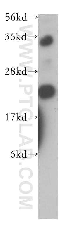 Western Blot (WB) analysis of human heart tissue using AK1 Polyclonal antibody (14978-1-AP)