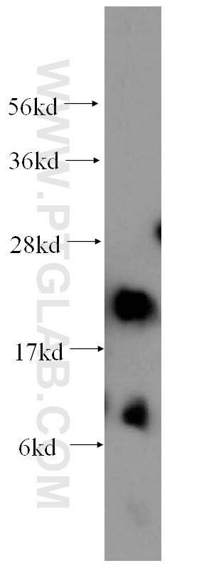 Western Blot (WB) analysis of human heart tissue using AK1 Polyclonal antibody (14978-1-AP)