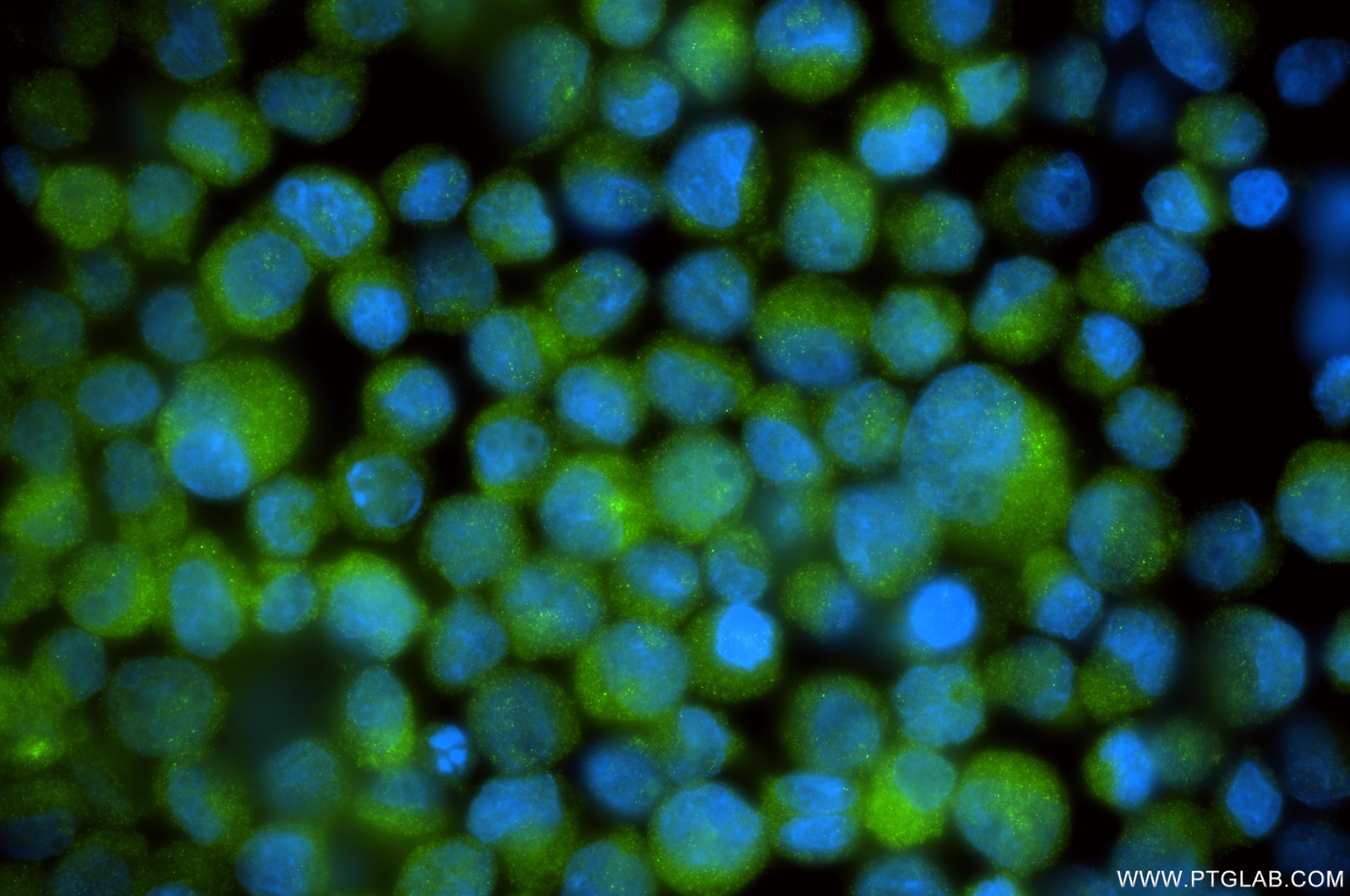 Immunofluorescent analysis of (4% PFA) fixed K-562 cells using AK1 antibody (85979-3-RR, Clone: 250557D10 ) at dilution of 1:200 and CoraLite®488-Conjugated Goat Anti-Rabbit IgG(H+L) (SA00013-2). Immunofluorescence (IF) / fluorescent staining of K-562 cells using AK1 Recombinant monoclonal antibody (85979-3-RR)