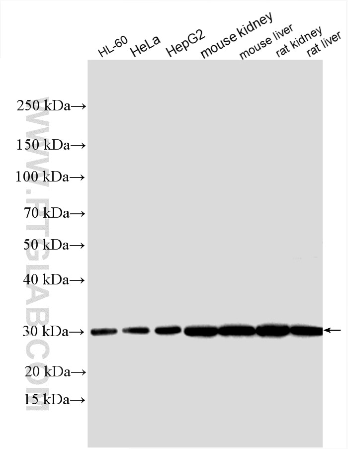 Western Blot (WB) analysis of various lysates using AK2 Polyclonal antibody (11014-1-AP)