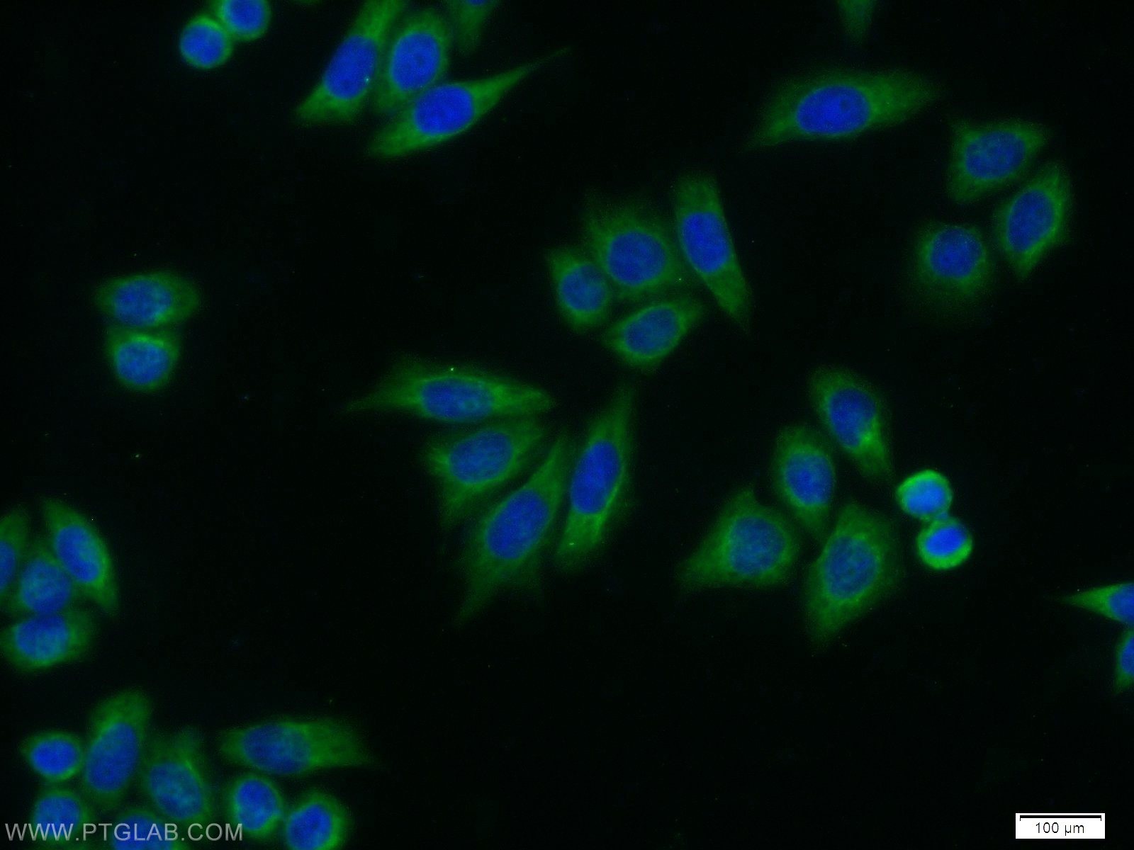 Immunofluorescence (IF) / fluorescent staining of HeLa cells using AK2 Monoclonal antibody (66127-1-Ig)
