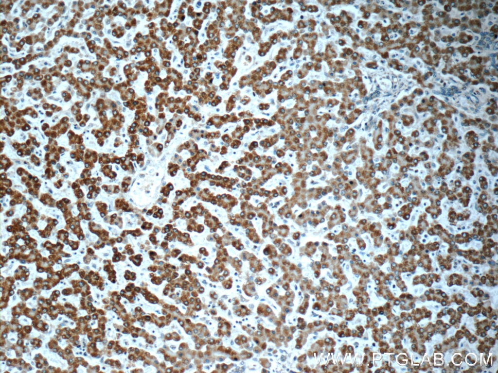Immunohistochemistry (IHC) staining of human liver tissue using AK2 Monoclonal antibody (66127-1-Ig)