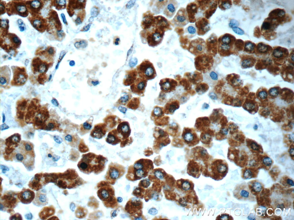 Immunohistochemistry (IHC) staining of human liver tissue using AK2 Monoclonal antibody (66127-1-Ig)