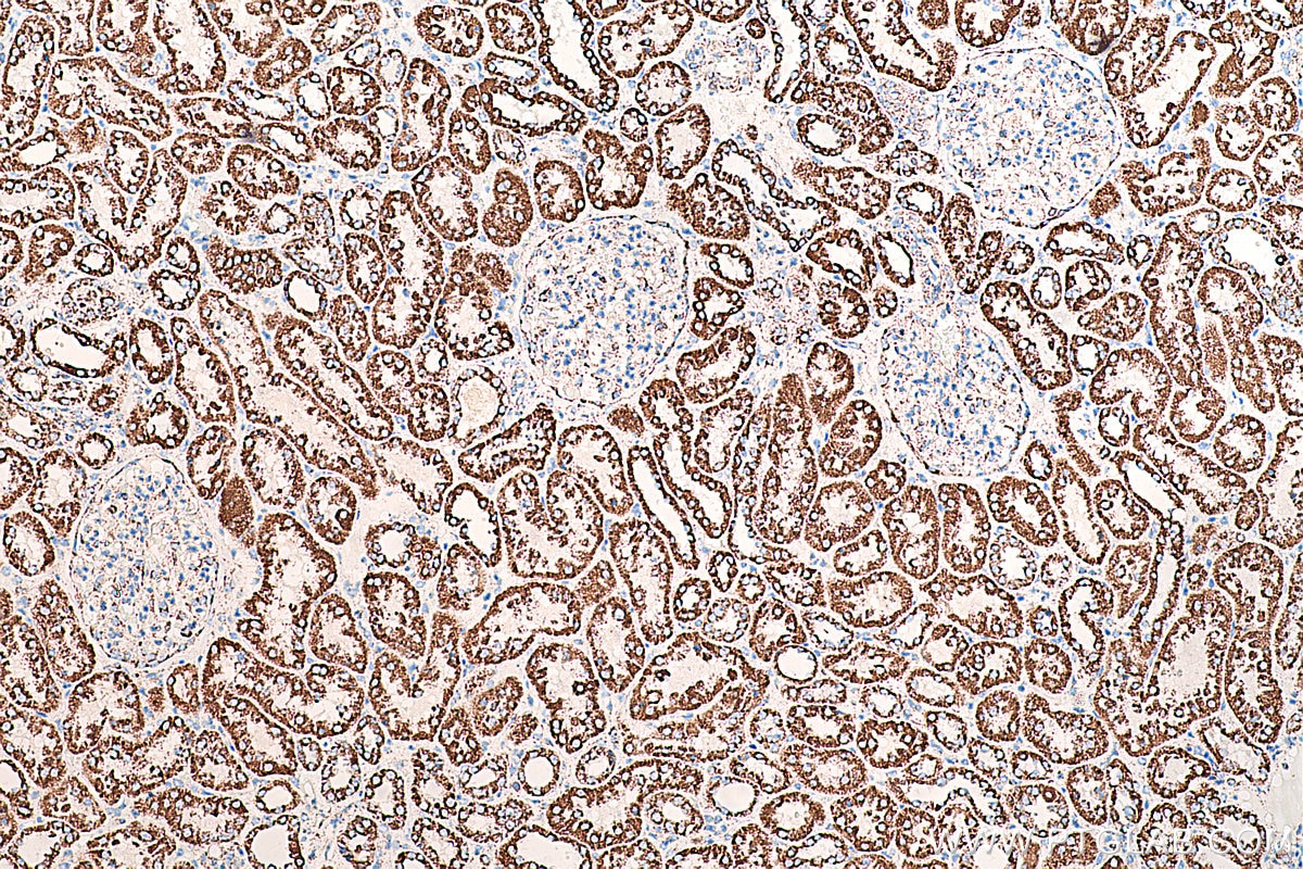 Immunohistochemistry (IHC) staining of human kidney tissue using AK2 Monoclonal antibody (66127-1-Ig)