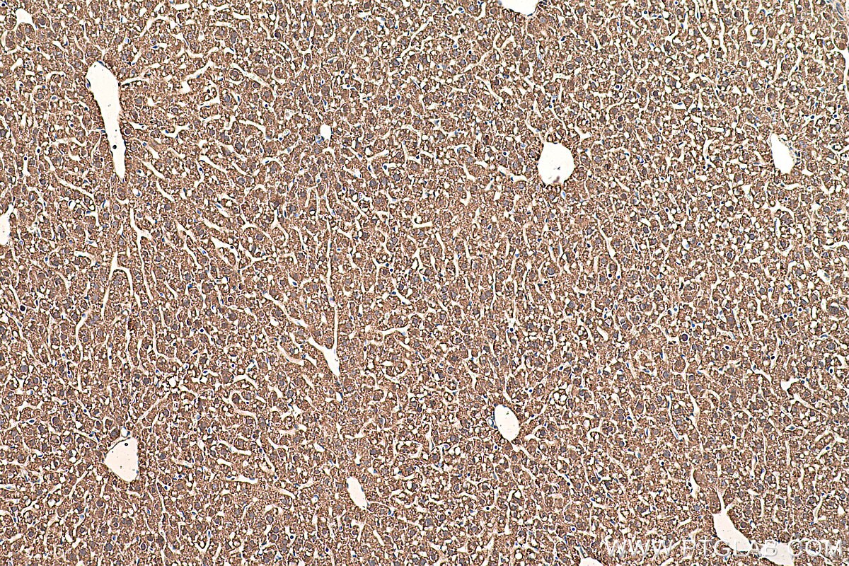 Immunohistochemistry (IHC) staining of mouse liver tissue using AK2 Monoclonal antibody (66127-1-Ig)