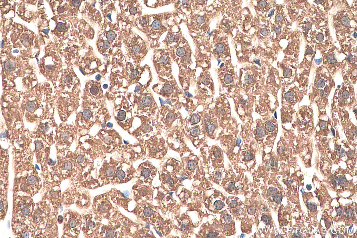 Immunohistochemistry (IHC) staining of mouse liver tissue using AK2 Monoclonal antibody (66127-1-Ig)