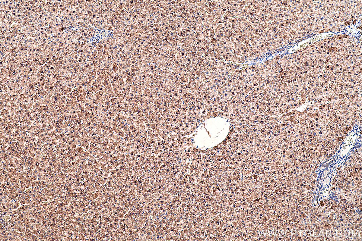 Immunohistochemistry (IHC) staining of rat liver tissue using AK2 Monoclonal antibody (66127-1-Ig)