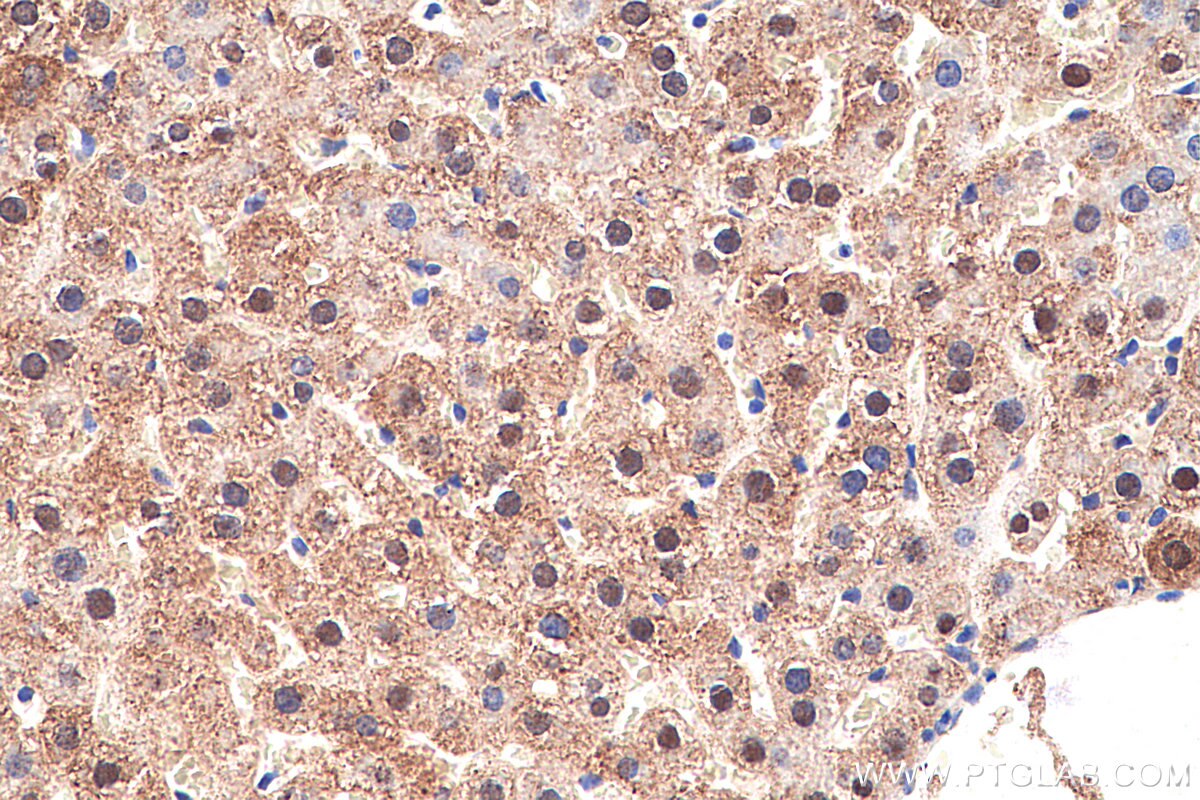 Immunohistochemistry (IHC) staining of rat liver tissue using AK2 Monoclonal antibody (66127-1-Ig)