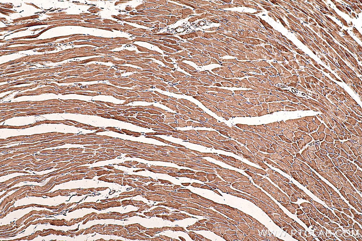 Immunohistochemistry (IHC) staining of mouse heart tissue using AK2 Monoclonal antibody (66127-1-Ig)