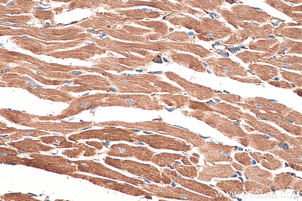 Immunohistochemistry (IHC) staining of mouse heart tissue using AK2 Monoclonal antibody (66127-1-Ig)