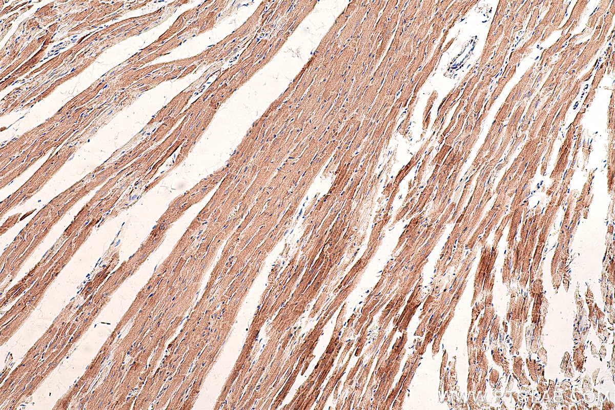 Immunohistochemistry (IHC) staining of rat heart tissue using AK2 Monoclonal antibody (66127-1-Ig)
