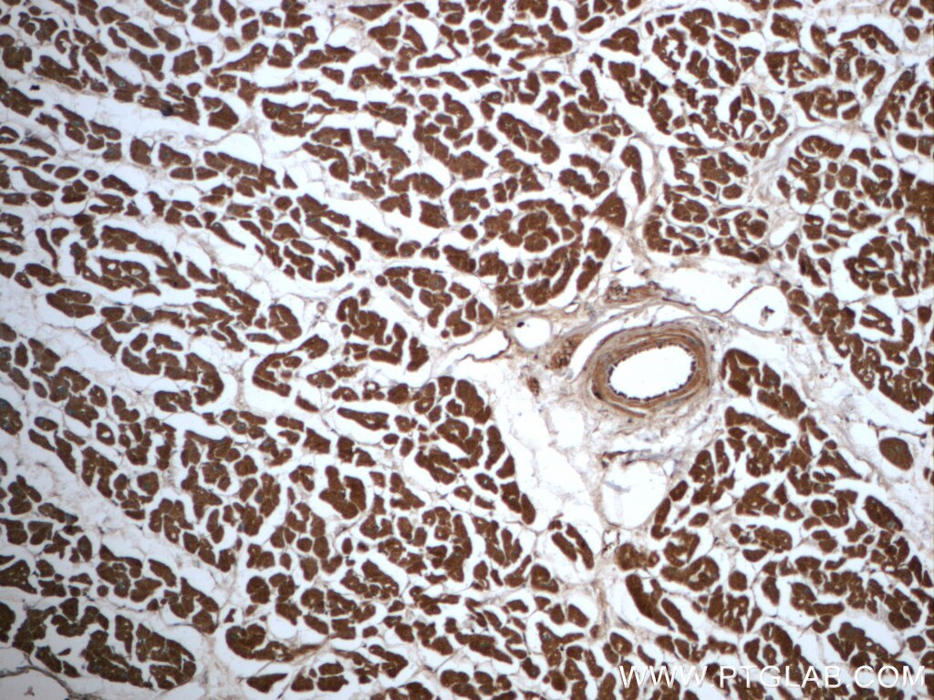 IHC staining of human heart using 66127-1-Ig