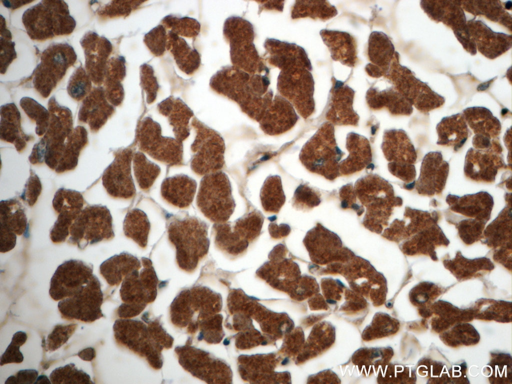 Immunohistochemistry (IHC) staining of human heart tissue using AK2 Monoclonal antibody (66127-1-Ig)