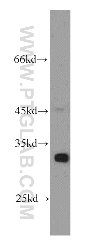 Western Blot (WB) analysis of HEK-293 cells using AK2 Monoclonal antibody (66127-1-Ig)