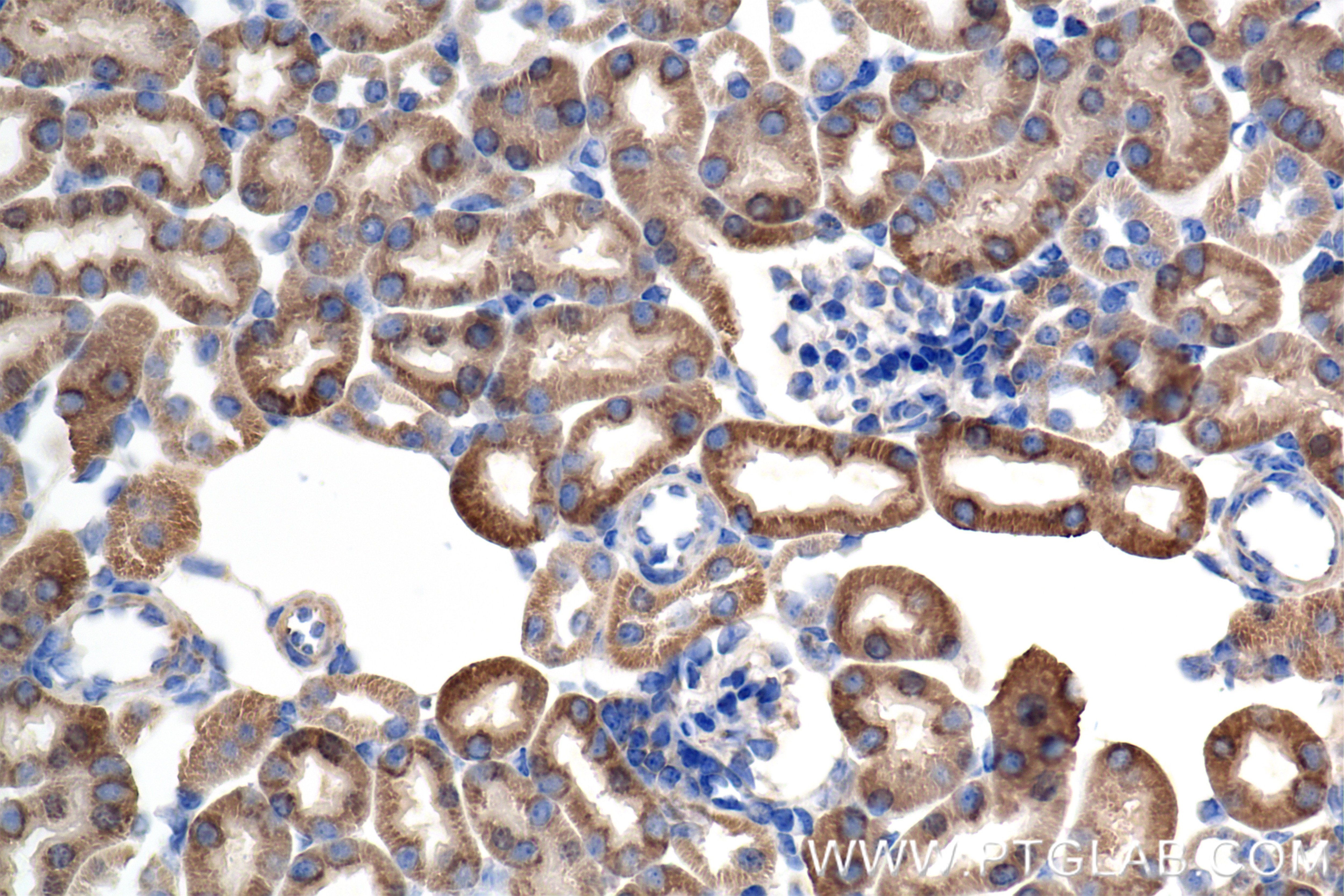 Immunohistochemistry (IHC) staining of mouse kidney tissue using AK2 Recombinant monoclonal antibody (85406-3-RR)