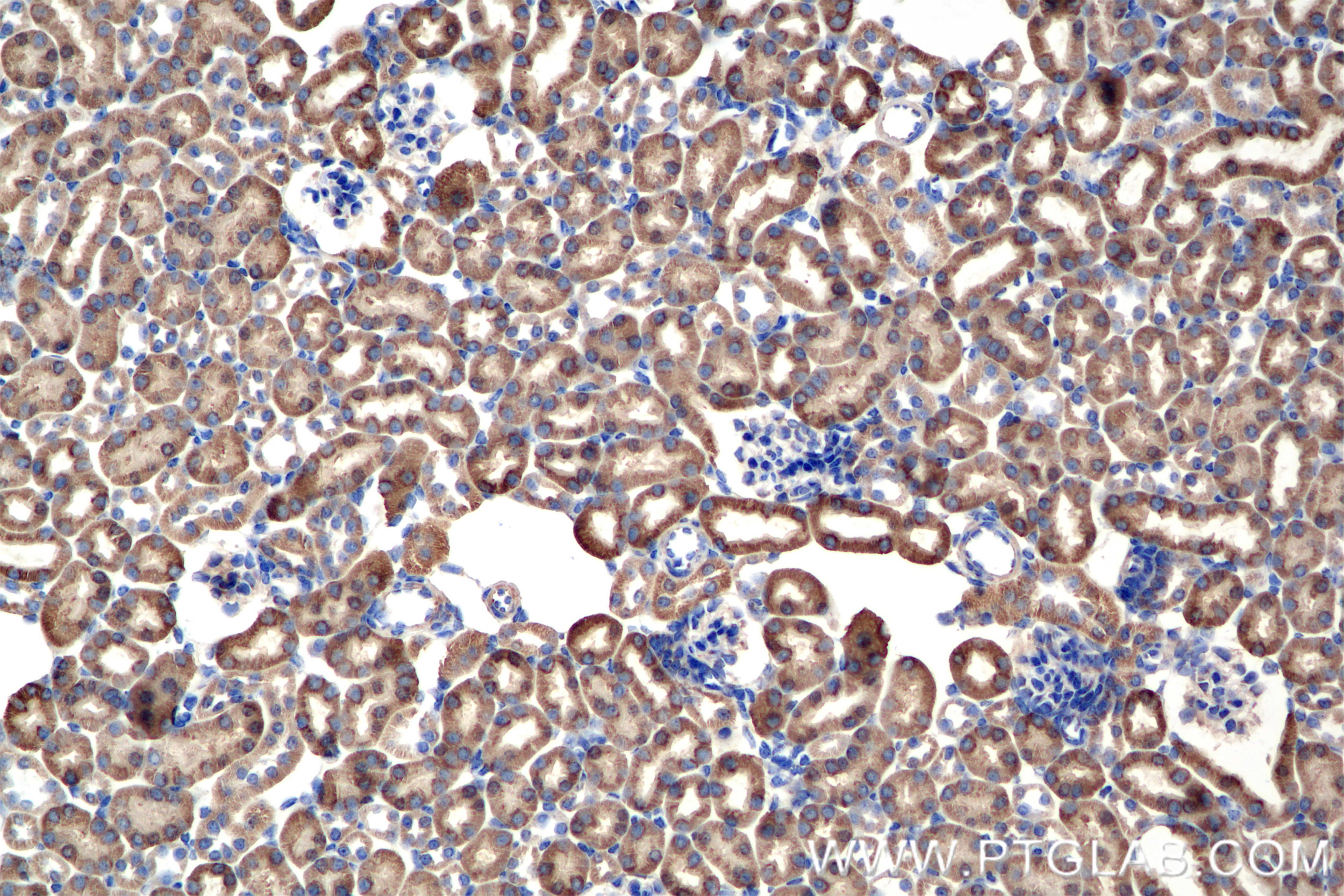Immunohistochemistry (IHC) staining of mouse kidney tissue using AK2 Recombinant monoclonal antibody (85406-3-RR)