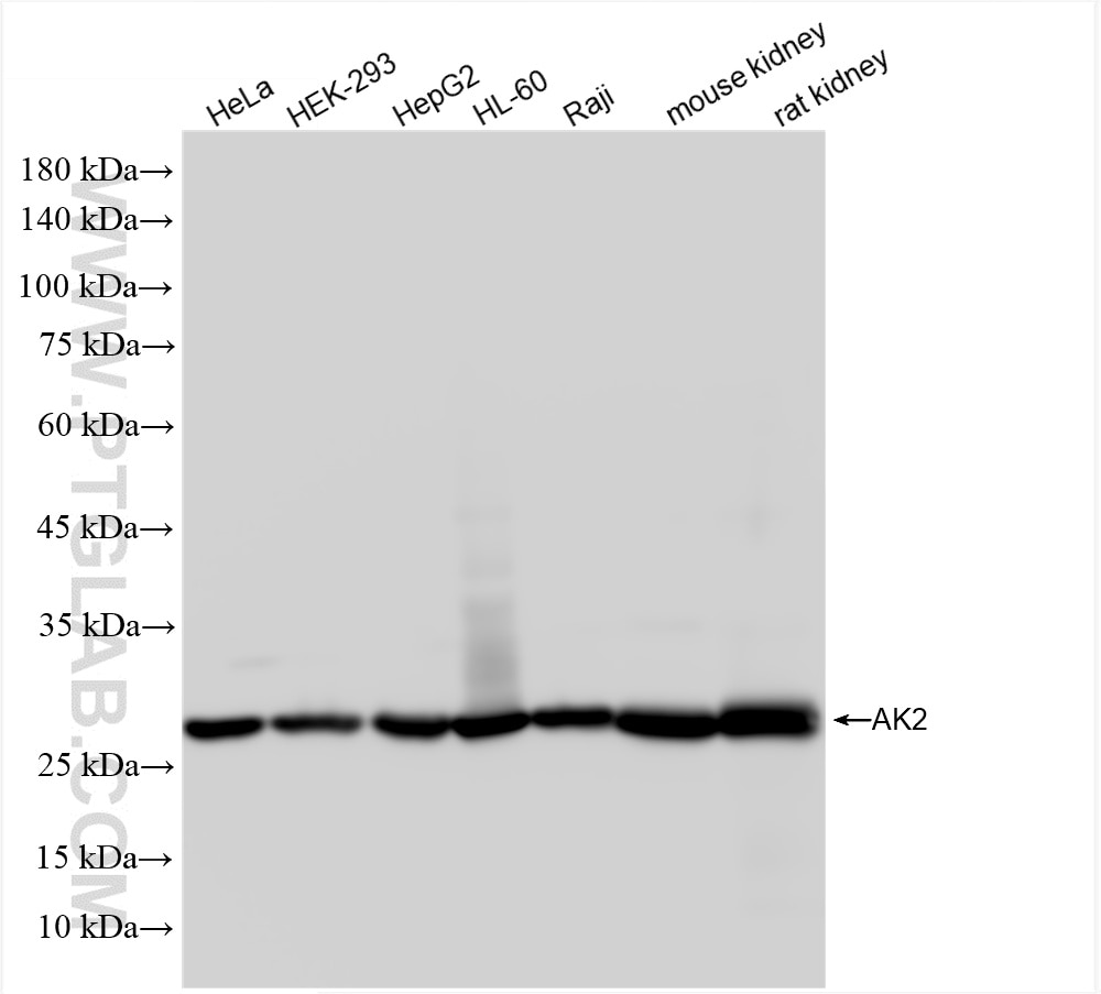 Western Blot (WB) analysis of various lysates using AK2 Recombinant antibody (85406-3-RR)
