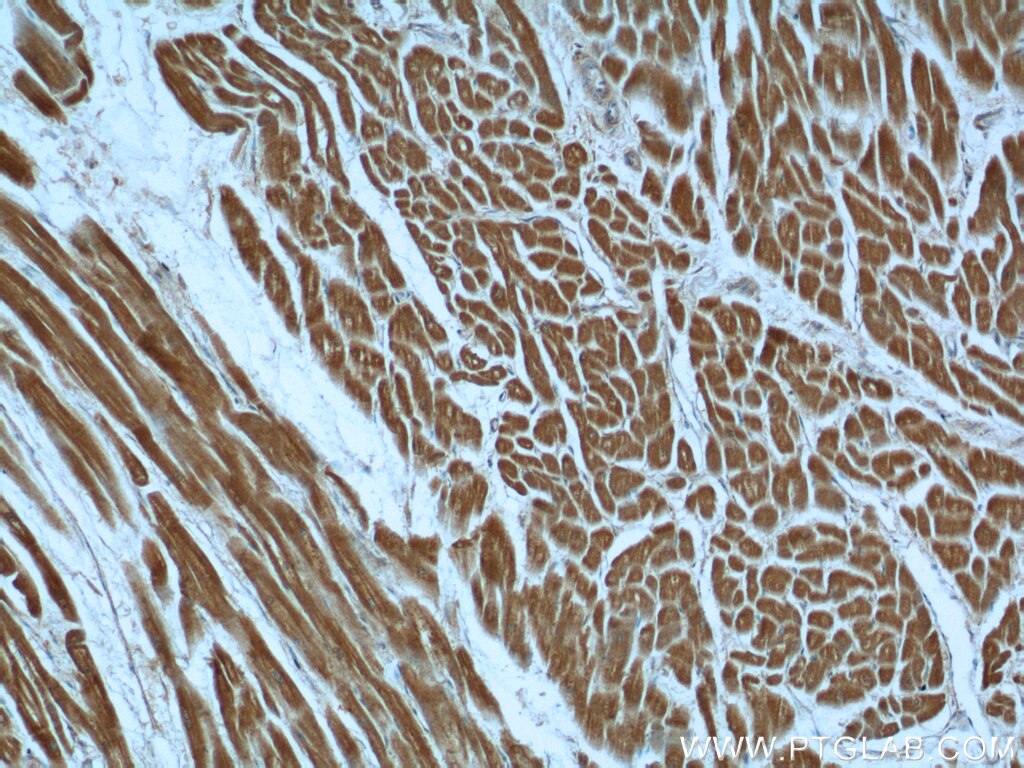 Immunohistochemistry (IHC) staining of human heart tissue using AK3 Polyclonal antibody (12562-1-AP)