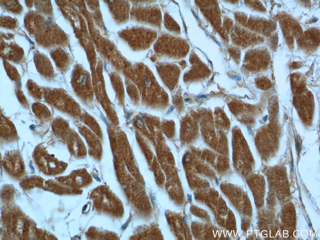 Immunohistochemistry (IHC) staining of human heart tissue using AK3 Polyclonal antibody (12562-1-AP)