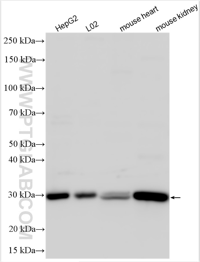 Western Blot (WB) analysis of various lysates using AK3 Polyclonal antibody (12562-1-AP)