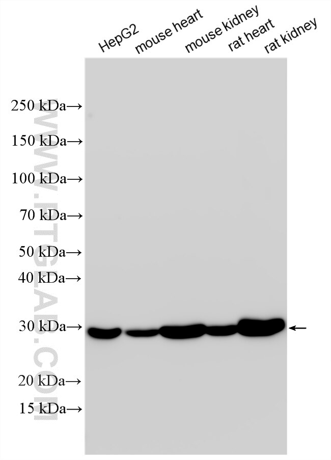 Various lysates were subjected to SDS PAGE followed by western blot with 12562-1-AP (AK3 antibody) at dilution of 1:15000 incubated at room temperature for 1.5 hours. Western Blot (WB) analysis of various lysates using AK3 Polyclonal antibody (12562-1-AP)