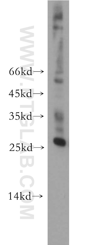 Western Blot (WB) analysis of HEK-293 cells using AK3 Polyclonal antibody (12562-1-AP)