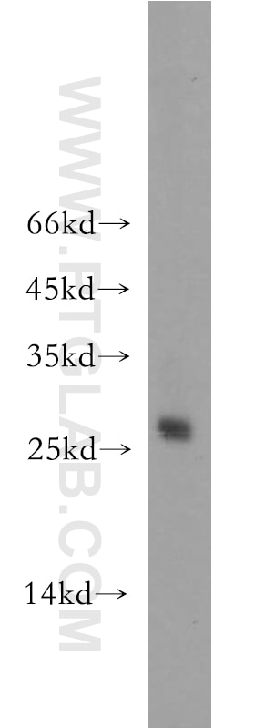 Western Blot (WB) analysis of HEK-293 cells using AK3 Polyclonal antibody (12562-1-AP)