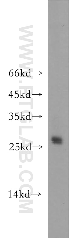 WB analysis of HEK-293 using 12562-1-AP