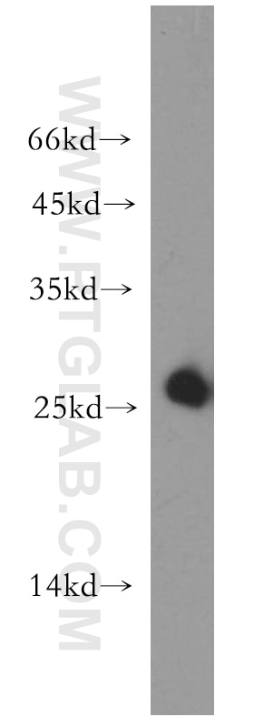 Western Blot (WB) analysis of human placenta tissue using AK3 Polyclonal antibody (12562-1-AP)