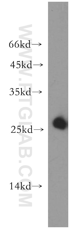 WB analysis of human placenta using 12562-1-AP