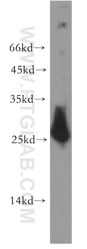 Western Blot (WB) analysis of human placenta tissue using AK3 Polyclonal antibody (12562-1-AP)