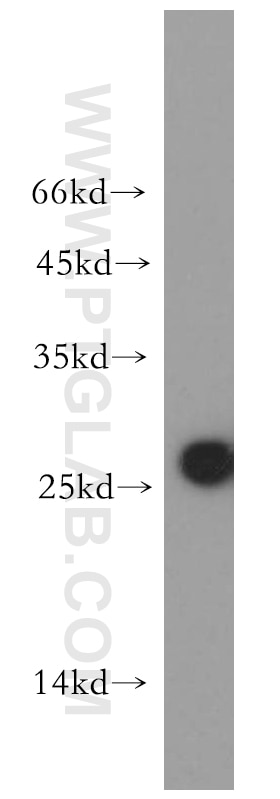 Western Blot (WB) analysis of mouse kidney tissue using AK3 Polyclonal antibody (12562-1-AP)