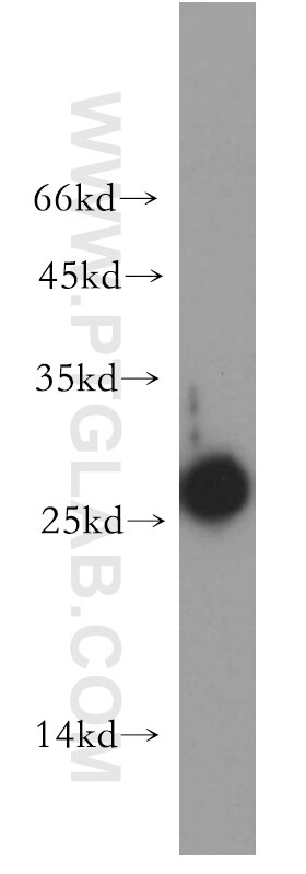 Western Blot (WB) analysis of mouse kidney tissue using AK3 Polyclonal antibody (12562-1-AP)