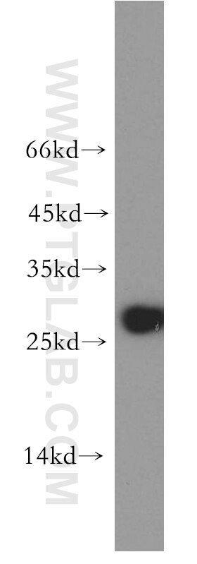 Western Blot (WB) analysis of BxPC-3 cells using AK3 Polyclonal antibody (12562-1-AP)