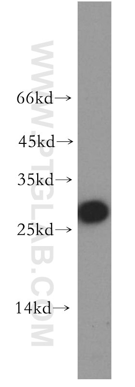 Western Blot (WB) analysis of BxPC-3 cells using AK3 Polyclonal antibody (12562-1-AP)