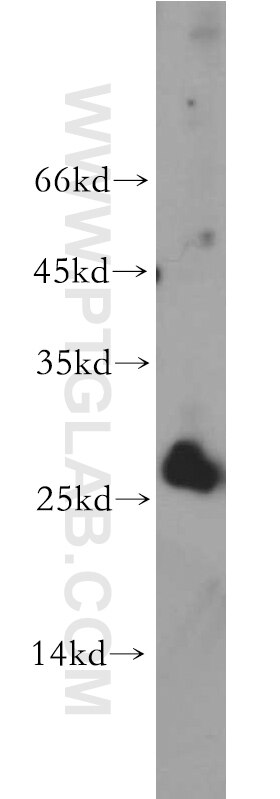 Western Blot (WB) analysis of L02 cells using AK3 Polyclonal antibody (12562-1-AP)