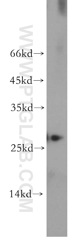 Western Blot (WB) analysis of L02 cells using AK3 Polyclonal antibody (12562-1-AP)