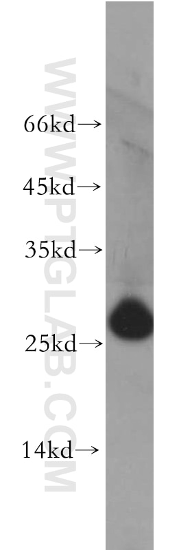 Western Blot (WB) analysis of MCF-7 cells using AK3 Polyclonal antibody (12562-1-AP)
