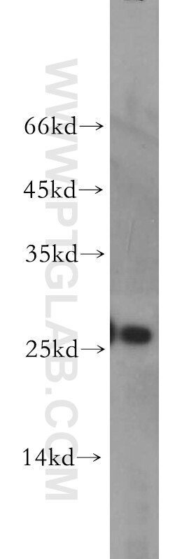 Western Blot (WB) analysis of MCF-7 cells using AK3 Polyclonal antibody (12562-1-AP)