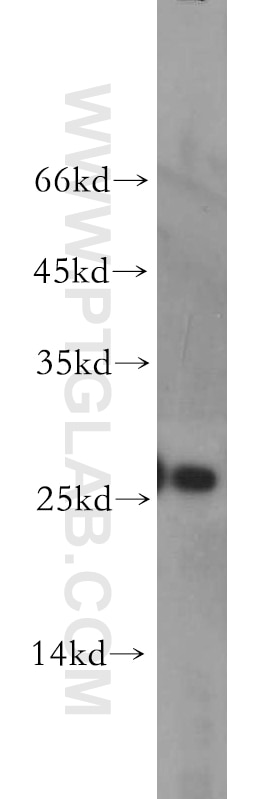 Western Blot (WB) analysis of MCF-7 cells using AK3 Polyclonal antibody (12562-1-AP)