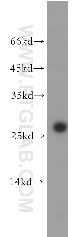 Western Blot (WB) analysis of HepG2 cells using AK3 Polyclonal antibody (12562-1-AP)