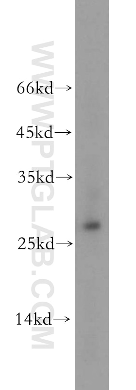 Western Blot (WB) analysis of HepG2 cells using AK3 Polyclonal antibody (12562-1-AP)