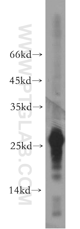 Western Blot (WB) analysis of mouse heart tissue using AK3 Polyclonal antibody (12562-1-AP)