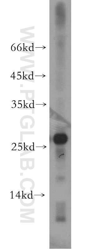 WB analysis of mouse heart using 12562-1-AP