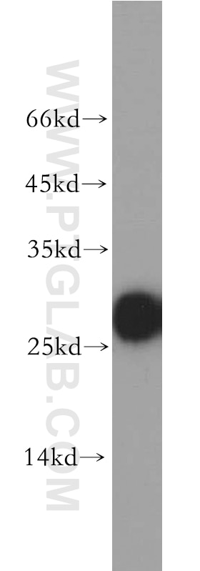 Western Blot (WB) analysis of mouse kidney tissue using AK3 Polyclonal antibody (12562-1-AP)