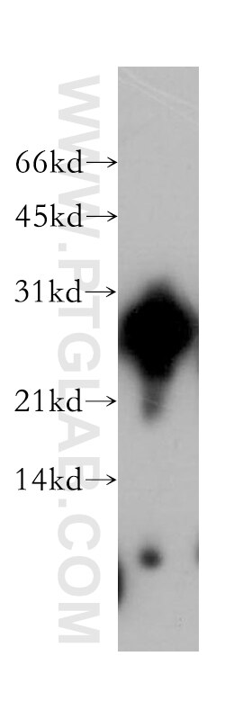 Western Blot (WB) analysis of human kidney tissue using AK3 Polyclonal antibody (12562-1-AP)